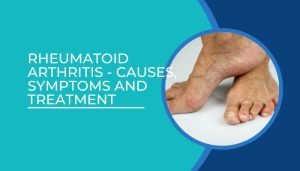 Rheumatoid arthritis