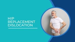 Hip replacement dislocation
