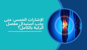 الكلمات المفتاحية: جراحة استبدال الركبة بالكامل