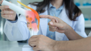 3D Printed Knee Replacement Technology