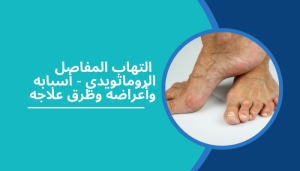   التهاب المفاصل الروماتويدي