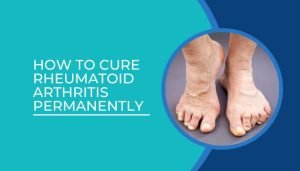 How to cure rheumatoid arthritis permanently