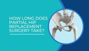 How long does partial hip replacement surgery take