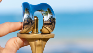 Total knee replacement surgery