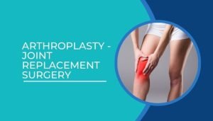 Arthroplasty - Joint replacement surgery