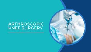 Arthroscopic knee surgery