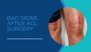 Bad Signs After ACL Surgery