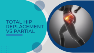 Total hip replacement vs partial