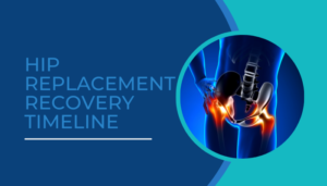 Hip replacement recovery