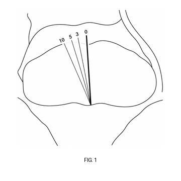 DMAM figure