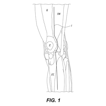 US 11,553,910 B1 figure