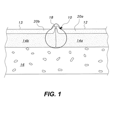 US 11,950,775 B2 figure