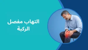 التهاب مفصل الركبة