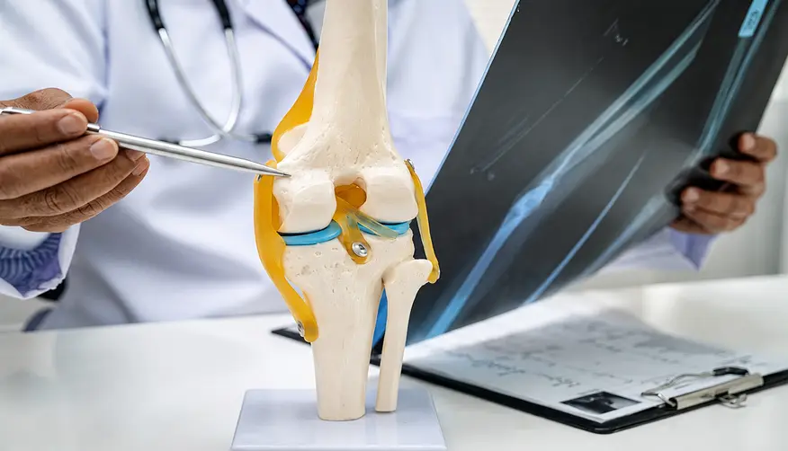 Knee Replacement Guide for Patie 1